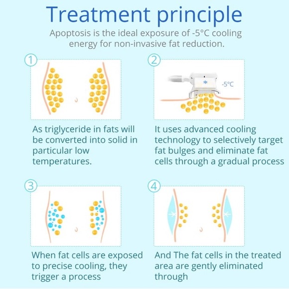 Coolscupting Machine - Picture 3 of 12